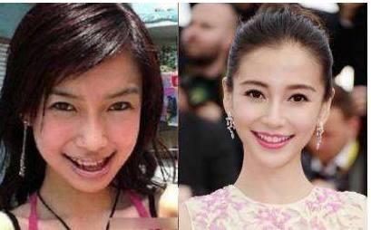 整牙对比照片,整牙前后对比，见证美丽蜕变瞬间